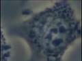 陰部かじり虫？恋恋病の恐怖！つつが虫病（短縮版）
