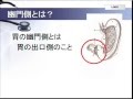 腹腔鏡下幽門側胃切除術とは？をわかりやすく。