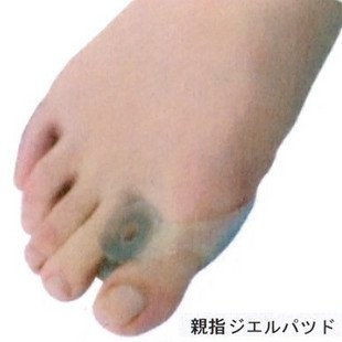 Bunion Pain