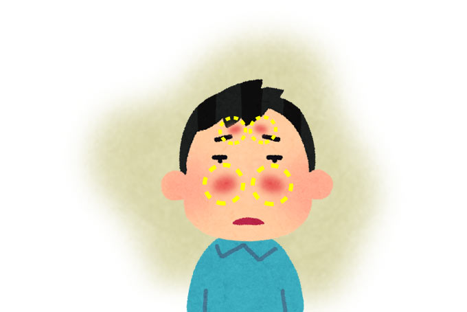 å¯é¼»èçã§ã¼ã¼ã£ã¨ããæãã®ç·æ§ã®ã¤ã©ã¹ã