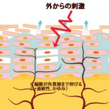 乾燥肌から敏感肌に。”過敏性”や”かゆみ”が起きる理由