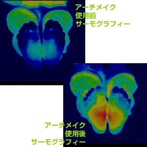 アーチメイクPRO ホワイト