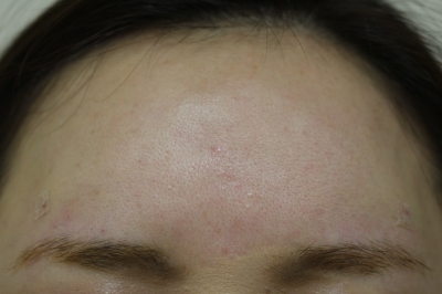 おでこは丸い方が女性らしくて美しい 美容のかかりつけ医を目指して