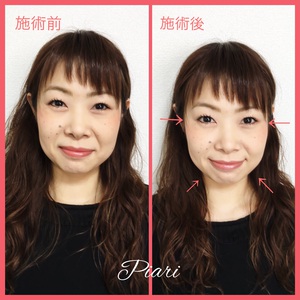 耳つぼジュエリーPiari