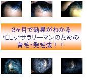 サラリーマンのための発毛・育毛支援サイト