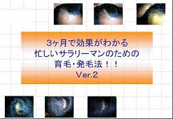 ３ヶ月で効果がわかる！サラリーマンのための発毛育毛法Vｅｒ.2