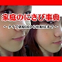 家庭のにきび事典～タイプ別原因から治療法まで～