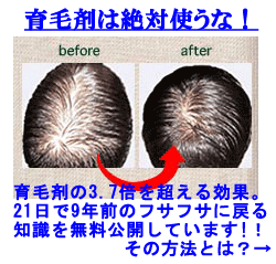 発毛メソッドシークレッツ