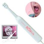 虫歯予防に見歯るくんで健康管理 口腔内内視鏡カメラ