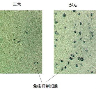 免疫抑制細胞 免疫抑制細胞
