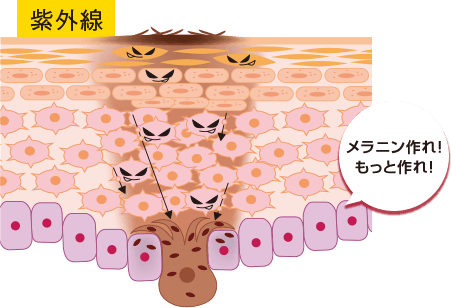シミができる原因 ※イメージ