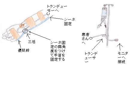 Aライン からだのブログ