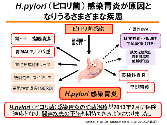「ピロリ菌」の画像検索結果
