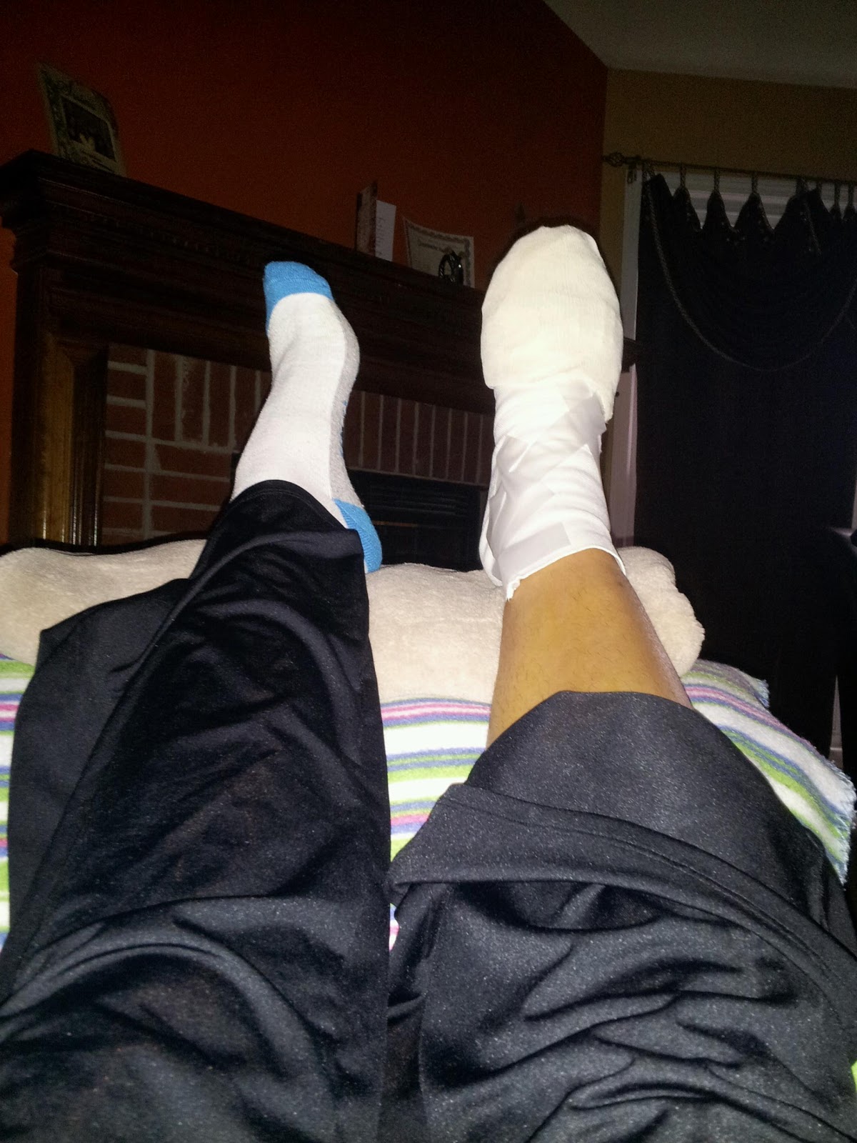 Hammer Toe