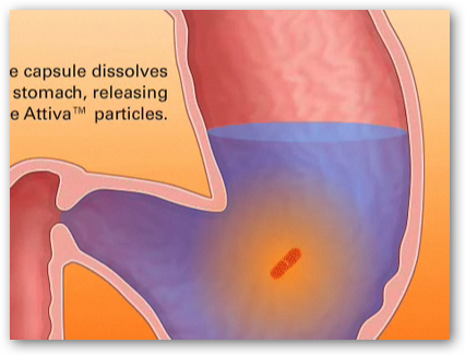 Does medicare cover gastric bypass.