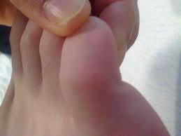 images (1)