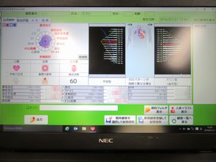 ブログ用　血流計04