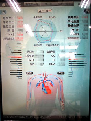 ブログ用　血流計06