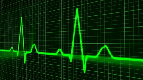 pulse-trace-163708_640