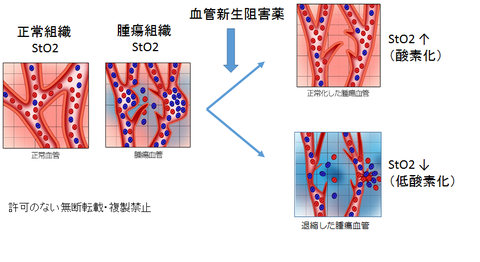 血管新生阻害薬とStO2