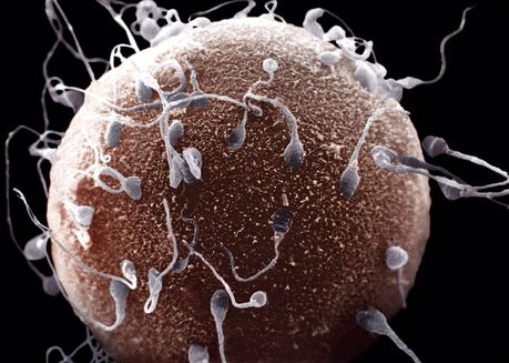 sperm_20090708_1275799755