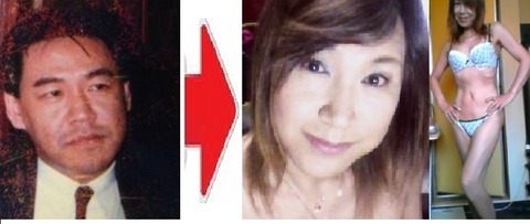 全身整形前後02ef1dd45