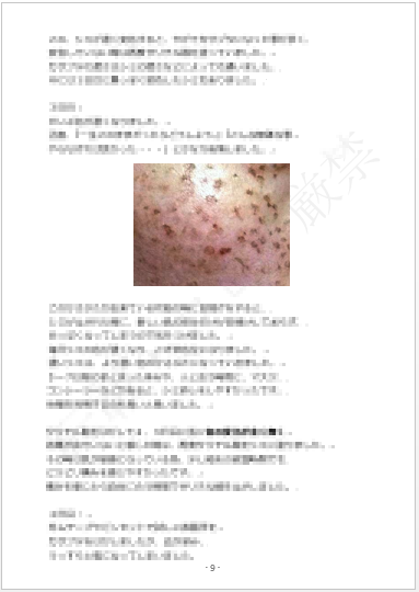 おうちで安く セルフシミ取り 頑固なシミ そばかすが たった1時間 数百円でポロポロ自力で簡単に取れた体験記