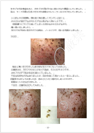 取っ 私 た の 自力 日間 記録 を 8 シミ で