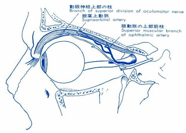 眼瞼下垂