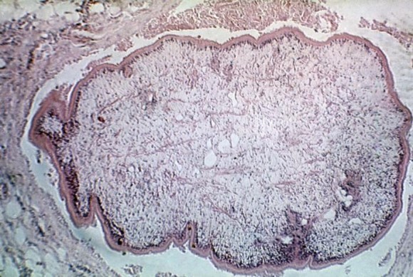 11_e14