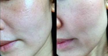 new_watermarkedpizapcom13632694785932s