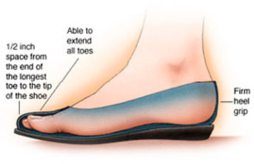 Bunions Callous