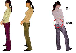 「反り腰 立ち方」の画像検索結果