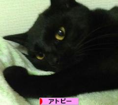 にほんブログ村 病気ブログ アトピー性皮膚炎へ