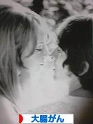 にほんブログ村 病気ブログ 大腸がんへ