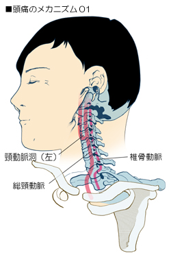 頭痛に関係する頚部の血管の走行