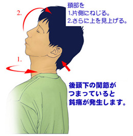 上部頚椎の神経根症の検査法
