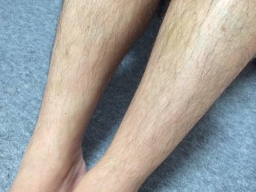 青のコラージュ女性なのに男性並にうじゃうじゃ体毛が生えてくる原因って パソコン アート 青のコラージュ女性なのに男性並にうじゃうじゃ体毛が生えてくる原因って パソコン アート