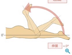 膝屈曲
