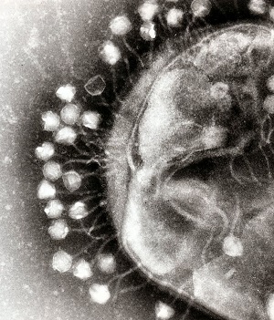 microchimerism2.JPG