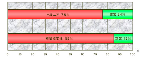 痛みがないヘルニア