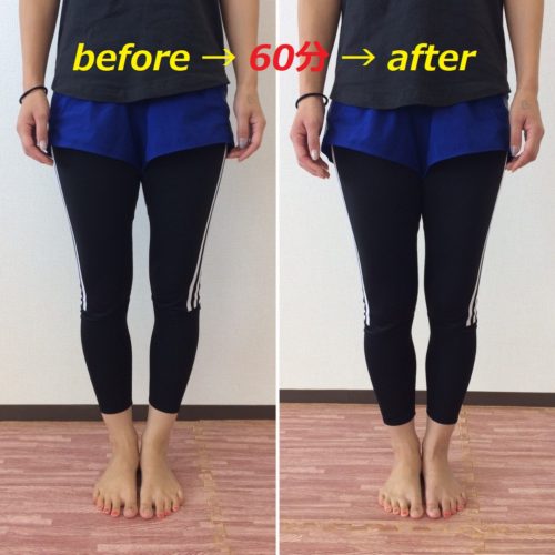 1%e5%9b%9e%e7%9b%ae-before-after%ef%bc%91