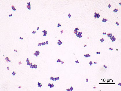 Staphylococcus aureus Gram.jpg
