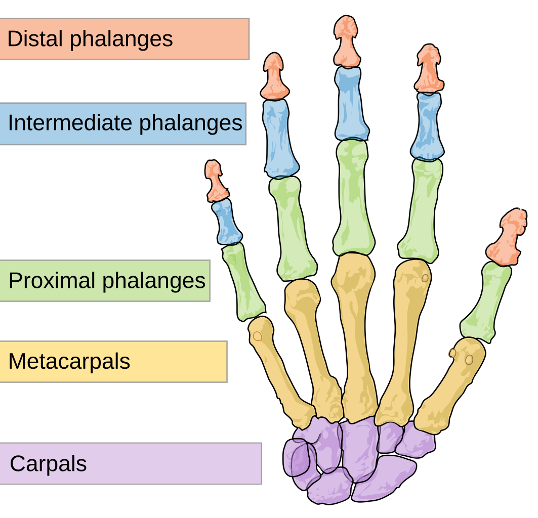 Hammertoe