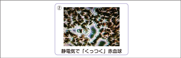 「体内静電気　シアル酸」の画像検索結果