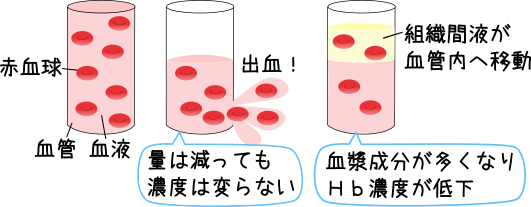 出血性ショックヘモグロビン