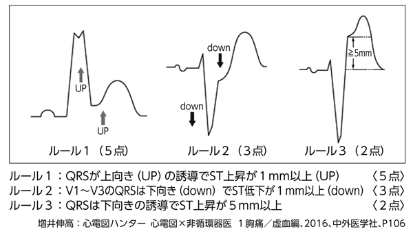 Amazon.co.jp: 心電図ハンター 1 胸痛 虚血編 : 産業・研究開発用品
