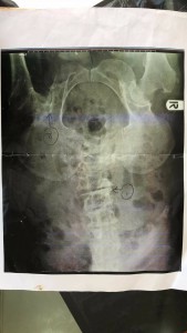 25383373_1590873401006451_698798712_o