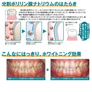 薬用デンタルホワイトプロ　フレッシュミント