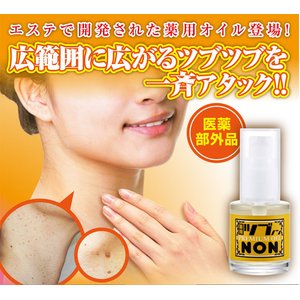 ツブNONノン【医薬部外品】